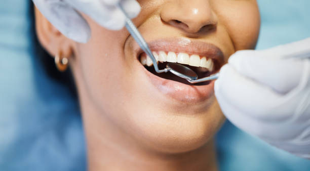 Best Urgent Tooth Repair  in Blackwater, AZ